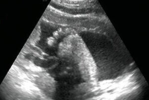 32 weken zwanger - Echo 32 weken - Kraamzorg So Cute